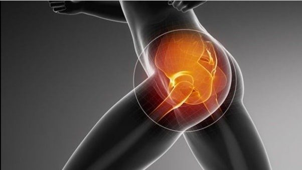 Gluteal image