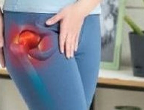 Lateral Hip Pain and Perimenopause: What Women in Their 40s Need to Know