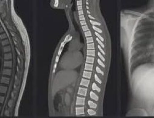 Do I need a scan before I see a Physio?